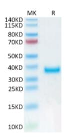 SDS-PAGE (PRLR-177H).jpg